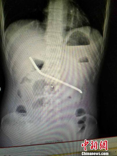 ����һ�����cŮ�Ѱ���ŭ��20�����L(zh��ng)䓽�